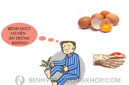 Có nên ăn nhiều trứng không khi bị gout