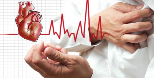 Phong thấp và bệnh tim có liên qua mật thiết