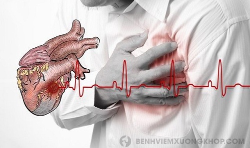 biến chứng bệnh viêm khớp dạng thấp về tim