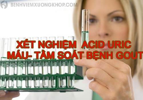 Xét nghiệm chỉ số acid uric 