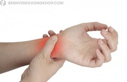 đau khớp cổ tay là gì