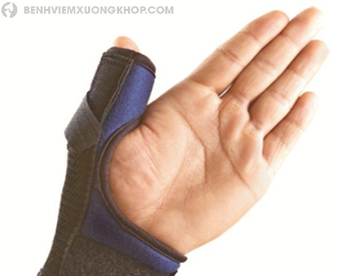 Dùng nẹp chữa đau khớp ngón tay cái