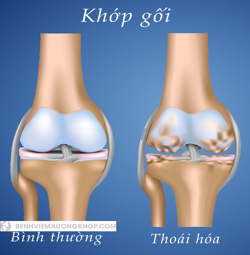 Có nhiều nguyên nhân gây ra chứng đau từ đầu gối xuống bàn chân