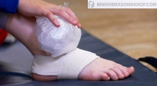 Dùng đá chườm có tác dụng giảm đau nhanh cho bệnh nhân viêm khớp bàn chân