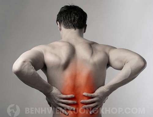 Hiện tượng đau cột sống lưng cơn đau