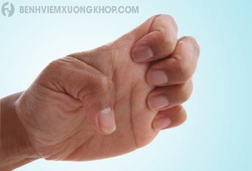 Cách giảm đau khớp ngón tay đơn giản