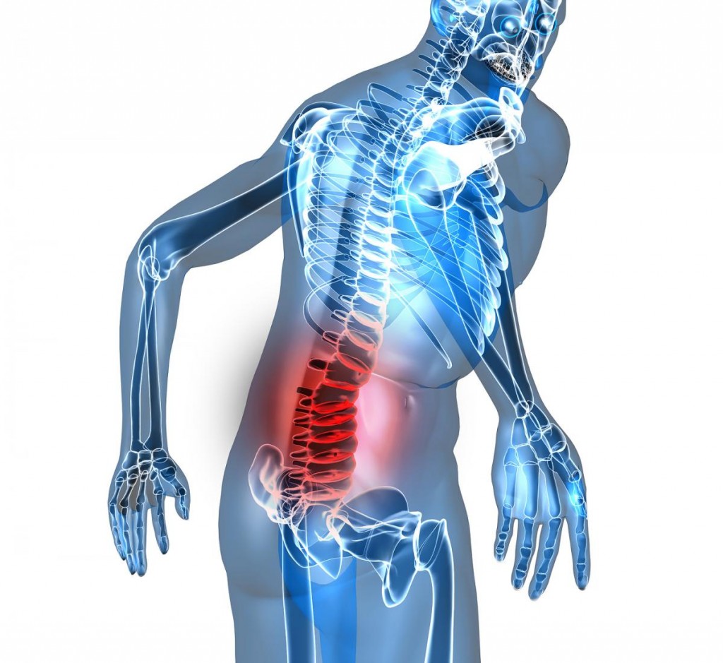Tìm cách chữa đau thắt lưng ở nam giới