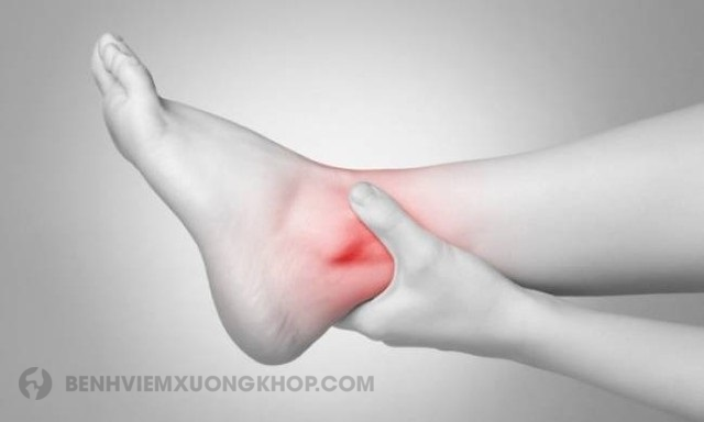 Bệnh viêm khớp cổ chân là gì 