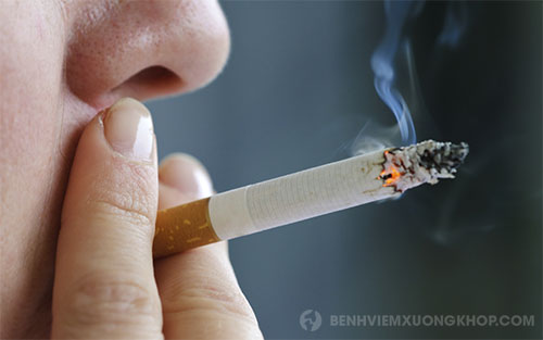Nguyên nhân gây thấp khớp thường gặp do hút thuốc lá