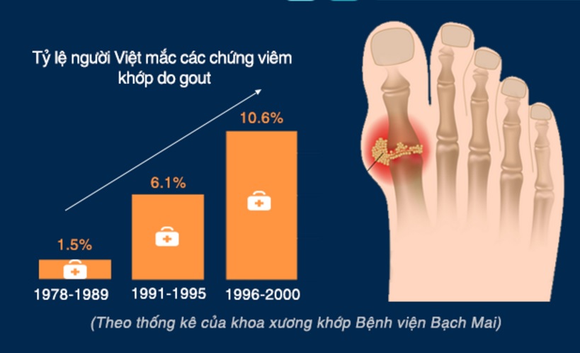 Tỷ lệ người mắc bệnh gout ở Việt Nam