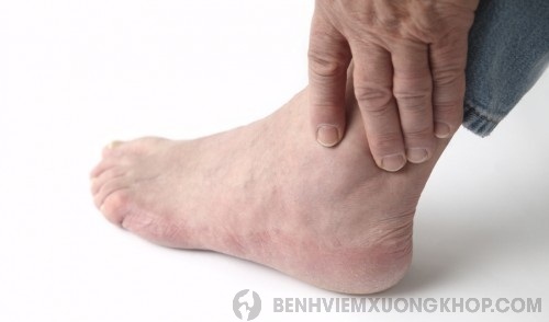 Bệnh thoái hóa khớp cổ chân là gì?