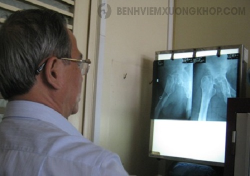 Đi khám để xem An Cốt Nam có tốt không?