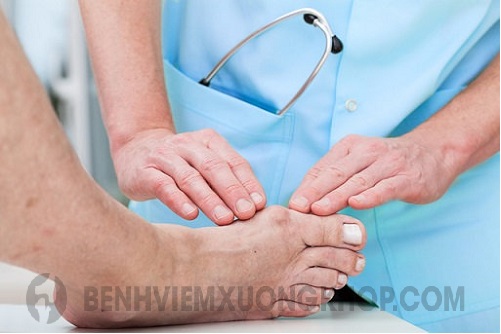 Viêm khớp ngón chân cái cần điều trị kịp thời