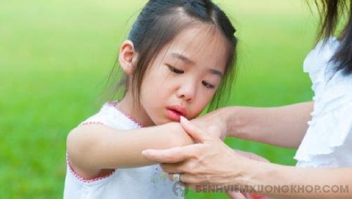 Nhận biết bệnh viêm khớp dạng thấp ở trẻ em