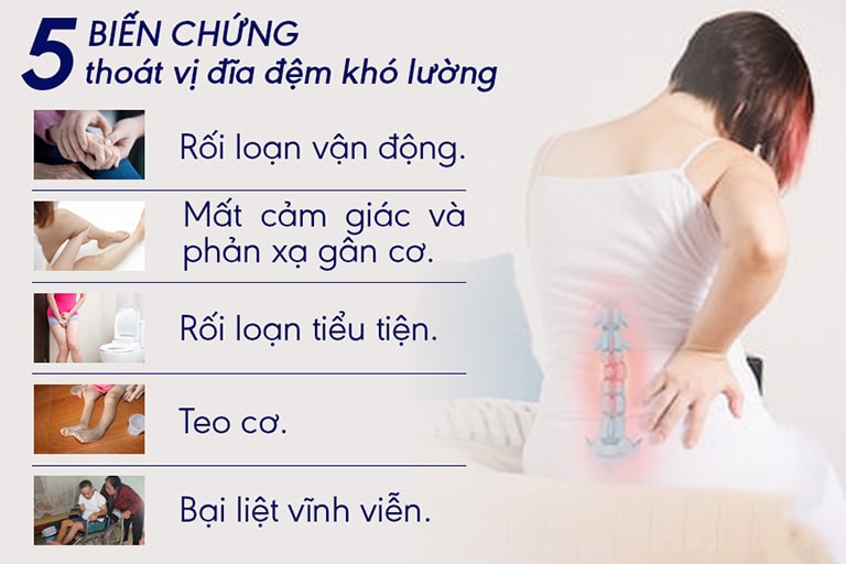 Các biến chứng bệnh thoát vị đĩa đệm