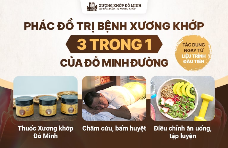 Phác đồ xương khớp của Đỗ Minh Đường