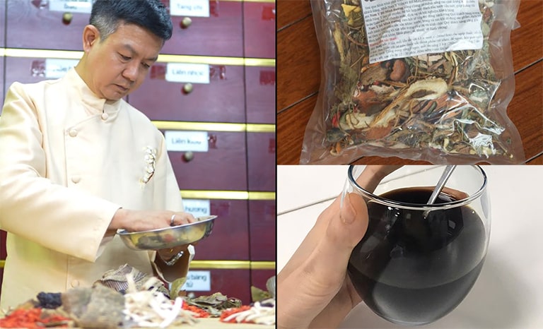 Liệu trình thuốc xương khớp của Đỗ Minh Đường