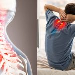 Thoái hóa đốt sống cổ ảnh hưởng lớn đến cuộc sống